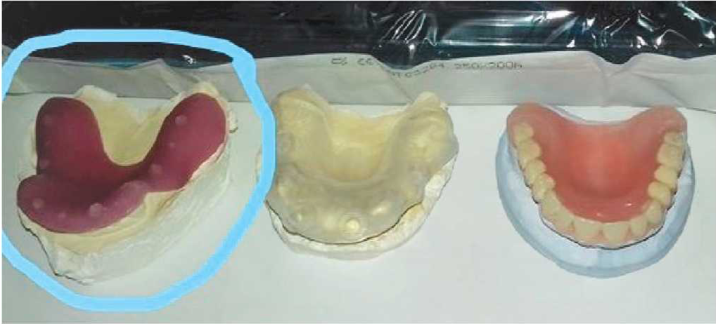 зубы
